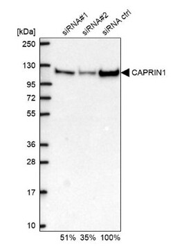 GPIP137 Antibody, Novus Biologicals:Antibodies:Primary Antibodies